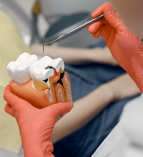 Dental Implants & Fixed Crowns